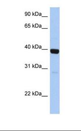 ZNF385B / ZNF533 Antibody - Fetal liver lysate. Antibody concentration: 1.0 ug/ml. Gel concentration: 12%.  This image was taken for the unconjugated form of this product. Other forms have not been tested.
