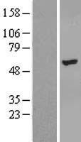 ZNF385B / ZNF533 Protein - Western validation with an anti-DDK antibody * L: Control HEK293 lysate R: Over-expression lysate