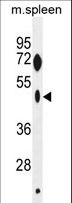 ZNF385C Antibody - ZNF385C Antibody western blot of mouse spleen tissue lysates (35 ug/lane). The ZNF385C antibody detected the ZNF385C protein (arrow).