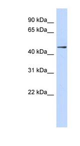 ZNF391 Antibody - ZNF391 antibody Western blot of Fetal Lung lysate. This image was taken for the unconjugated form of this product. Other forms have not been tested.