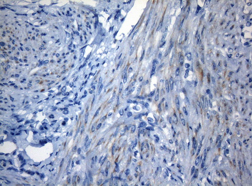 ZNF394 Antibody - Immunohistochemical staining of paraffin-embedded Human endometrium tissue within the normal limits using anti-ZNF394 mouse monoclonal antibody. (Heat-induced epitope retrieval by 1mM EDTA in 10mM Tris buffer. (pH8.5) at 120°C for 3 min. (1:150)