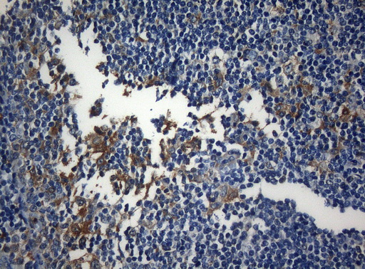 ZNF394 Antibody - Immunohistochemical staining of paraffin-embedded Human lymph node tissue within the normal limits using anti-ZNF394 mouse monoclonal antibody. (Heat-induced epitope retrieval by 1mM EDTA in 10mM Tris buffer. (pH8.5) at 120°C for 3 min. (1:150)
