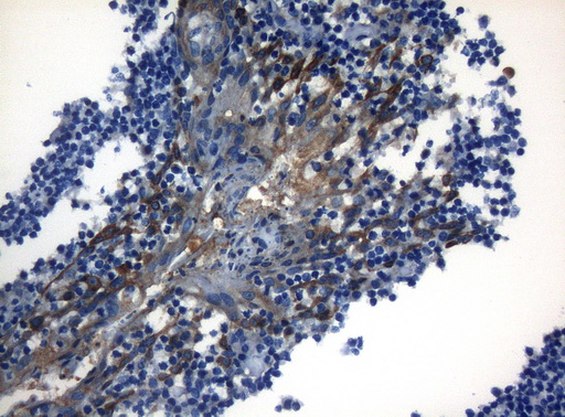 ZNF394 Antibody - Immunohistochemical staining of paraffin-embedded Human tonsil within the normal limits using anti-ZNF394 mouse monoclonal antibody. (Heat-induced epitope retrieval by 1mM EDTA in 10mM Tris buffer. (pH8.5) at 120°C for 3 min. (1:150)