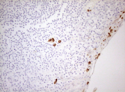 ZNF394 Antibody - Immunohistochemical staining of paraffin-embedded Human tonsil within the normal limits using anti-ZNF394 mouse monoclonal antibody. (Heat-induced epitope retrieval by 1mM EDTA in 10mM Tris buffer. (pH8.5) at 120°C for 3 min. (1:150)