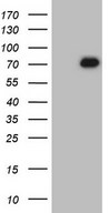 ZNF394 Antibody - HEK293T cells were transfected with the pCMV6-ENTRY control. (Left lane) or pCMV6-ENTRY ZNF394. (Right lane) cDNA for 48 hrs and lysed. Equivalent amounts of cell lysates. (5 ug per lane) were separated by SDS-PAGE and immunoblotted with anti-ZNF394. (1:2000)