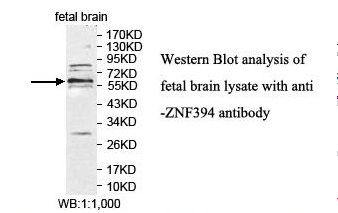 ZNF394 Antibody