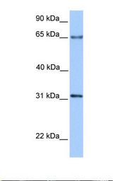 ZNF394 Antibody - Transfected 293T cell lysate. Antibody concentration: 1.0 ug/ml. Gel concentration: 12%.  This image was taken for the unconjugated form of this product. Other forms have not been tested.