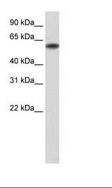 ZNF394 Antibody - Transfected 293T Cell Lysate.  This image was taken for the unconjugated form of this product. Other forms have not been tested.