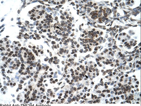 ZNF394 Antibody - ZNF394 antibody ARP30072_P050-NP_115540-ZNF394 (zinc finger protein 394) Antibody was used in IHC to stain formalin-fixed, paraffin-embedded human pancreas.  This image was taken for the unconjugated form of this product. Other forms have not been tested.