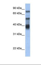 ZNF395 Antibody - Transfected 293T cell lysate. Antibody concentration: 1.0 ug/ml. Gel concentration: 12%.  This image was taken for the unconjugated form of this product. Other forms have not been tested.