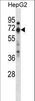 ZNF395 Antibody - ZNF395 Antibody western blot of HepG2 cell line lysates (35 ug/lane). The ZNF395 antibody detected the ZNF395 protein (arrow).