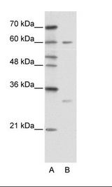 ZNF395 Antibody - A: Marker, B: HepG2 Cell Lysate.  This image was taken for the unconjugated form of this product. Other forms have not been tested.