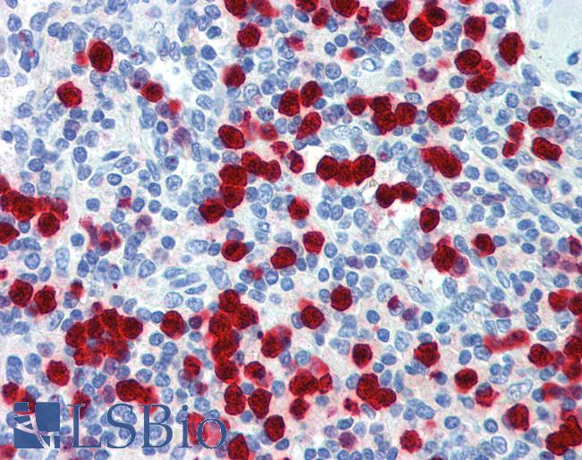 ZNF395 Antibody - Anti-ZNF395 antibody IHC of human spleen. Immunohistochemistry of formalin-fixed, paraffin-embedded tissue after heat-induced antigen retrieval. Antibody concentration 5 ug/ml.  This image was taken for the unconjugated form of this product. Other forms have not been tested.