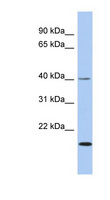 ZNF396 Antibody - ZNF396 antibody Western blot of Fetal Small Intestine lysate. This image was taken for the unconjugated form of this product. Other forms have not been tested.