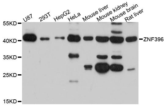 ZNF396 Antibody - Western blot analysis of extracts of various cell lines, using ZNF396 antibody at 1:3000 dilution. The secondary antibody used was an HRP Goat Anti-Rabbit IgG (H+L) at 1:10000 dilution. Lysates were loaded 25ug per lane and 3% nonfat dry milk in TBST was used for blocking. An ECL Kit was used for detection and the exposure time was 50s.