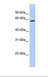 ZNF397 Antibody - Fetal brain lysate. Antibody concentration: 1.0 ug/ml. Gel concentration: 12%.  This image was taken for the unconjugated form of this product. Other forms have not been tested.