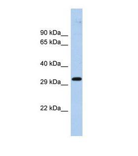 ZNF397 Antibody - Western blot of Human Fetal Brain. ZNF397 antibody dilution 1.0 ug/ml.  This image was taken for the unconjugated form of this product. Other forms have not been tested.