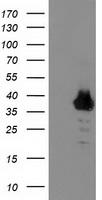 ZNF397 Antibody - HEK293T cells were transfected with the pCMV6-ENTRY control (Left lane) or pCMV6-ENTRY ZNF397 (Right lane) cDNA for 48 hrs and lysed. Equivalent amounts of cell lysates (5 ug per lane) were separated by SDS-PAGE and immunoblotted with anti-ZNF397.