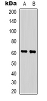 ZNF397 Antibody - Western blot analysis of ZNF397 expression in HepG2 (A); HeLa (B) whole cell lysates.