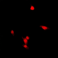 ZNF397 Antibody - Immunofluorescent analysis of ZNF397 staining in HepG2 cells. Formalin-fixed cells were permeabilized with 0.1% Triton X-100 in TBS for 5-10 minutes and blocked with 3% BSA-PBS for 30 minutes at room temperature. Cells were probed with the primary antibody in 3% BSA-PBS and incubated overnight at 4 deg C in a humidified chamber. Cells were washed with PBST and incubated with a DyLight 594-conjugated secondary antibody (red) in PBS at room temperature in the dark. DAPI was used to stain the cell nuclei (blue).