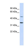 ZNF398 Antibody - ZNF398 antibody Western blot of 293T cell lysate. This image was taken for the unconjugated form of this product. Other forms have not been tested.