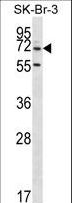 ZNF398 Antibody - ZNF398 Antibody western blot of SK-BR-3 cell line lysates (35 ug/lane). The ZNF398 antibody detected the ZNF398 protein (arrow).