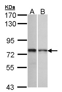 ZNF398 Antibody - Sample (30 ug of whole cell lysate). A: 293T. B: H1299. 7.5% SDS PAGE. ZNF398 antibody diluted at 1:1000. 