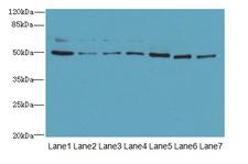 ZNF398 Antibody - Western blot. All lanes: ZNF398 antibody at 3 ug/ml. Lane 1: 293T whole cell lysate. Lane 2: HeLa whole cell lysate. Lane 3: HepG-2 whole cell lysate. Lane 4: Jurkat whole cell lysate. Lane 5: MCF7 whole cell lysate. Lane 6: Caco-2 whole cell lysate. Lane 7: A549 whole cell lysate. Secondary Goat polyclonal to Rabbit IgG at 1:10000 dilution. Predicted band size: 71 kDa. Observed band size: 50,70 kDa.