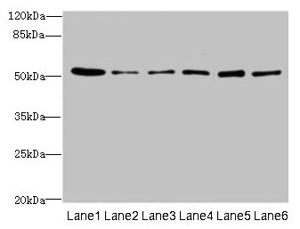 ZNF398 Antibody - Western blot All lanes: ZNF398 antibody at 3µg/ml Lane 1: 293T whole cell lysate Lane 2: Hela whole cell lysate Lane 3: HepG2 whole cell lysate Lane 4: Jurkat whole cell lysate Lane 5: MCF-7 whole cell lysate Lane 6: Caco-2 whole cell lysate Lane 7: A549 whole cell lysate Secondary Goat polyclonal to rabbit IgG at 1/10000 dilution Predicted band size: 72, 53 kDa Observed band size: 53 kDa