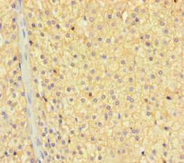 ZNF404 Antibody - Immunohistochemistry of paraffin-embedded human adrenal gland tissue using ZNF404 Antibody at dilution of 1:100