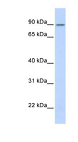ZNF408 / PRDM17 Antibody - ZNF408 antibody Western blot of Transfected 293T cell lysate. This image was taken for the unconjugated form of this product. Other forms have not been tested.