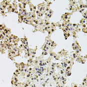 ZNF408 / PRDM17 Antibody - Immunohistochemistry of paraffin-embedded rat lung tissue.