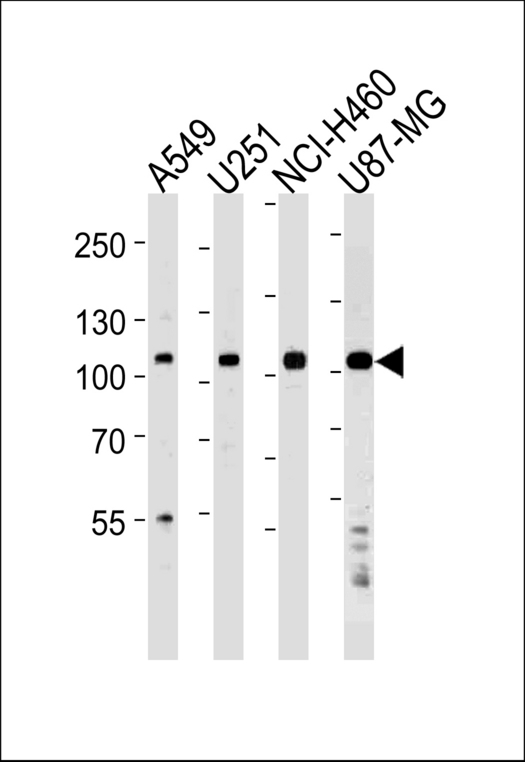 ZNF41 Antibody - Western blot of lysates from A549,U251,NCI-H460,U87-MG cell line (from left to right),using ZNF41 Antibody. Antibody was diluted at 1:1000 at each lane. A goat anti-rabbit IgG H&L (HRP) at 1:5000 dilution was used as the secondary antibody.Lysates at 35ug per lane.