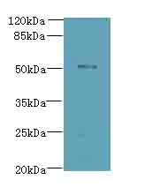 ZNF410 Antibody - Western blot. All lanes: ZNF410 antibody at 3 ug/ml+Mos- brain tissue Goat polyclonal to rabbit at 1:10000 dilution. Predicted band size: 52 kDa. Observed band size: 52 kDa.