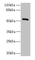 ZNF410 Antibody - Western blot All lanes: ZNF410 antibody at 3µg/ml + Mouse brain tissue Secondary Goat polyclonal to rabbit IgG at 1/10000 dilution Predicted band size: 53, 30, 48, 45, 56 kDa Observed band size: 53 kDa