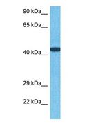ZNF410 Antibody - Western blot of ZN410 Antibody with human MCF7 Whole Cell lysate.  This image was taken for the unconjugated form of this product. Other forms have not been tested.