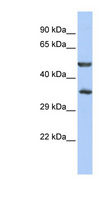 ZNF414 Antibody - ZNF414 antibody Western blot of HepG2 cell lysate. This image was taken for the unconjugated form of this product. Other forms have not been tested.