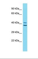 ZNF414 Antibody - Western blot of Human Stomach Tumor. ZNF414 antibody dilution 1.0 ug/ml.  This image was taken for the unconjugated form of this product. Other forms have not been tested.
