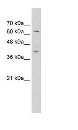 ZNF415 Antibody - Jurkat Cell Lysate.  This image was taken for the unconjugated form of this product. Other forms have not been tested.