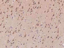 ZNF415 Antibody - Immunochemical staining of human ZNF415 in human brain with rabbit polyclonal antibody at 1:100 dilution, formalin-fixed paraffin embedded sections.