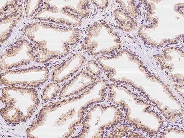 ZNF415 Antibody - Immunochemical staining of human ZNF415 in human prostate with rabbit polyclonal antibody at 1:100 dilution, formalin-fixed paraffin embedded sections.