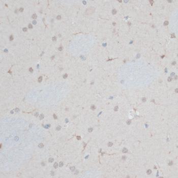 ZNF415 Antibody - Immunohistochemistry of paraffin-embedded Rat brain using ZNF415 Polyclonal Antibody at dilution of 1:100 (40x lens).