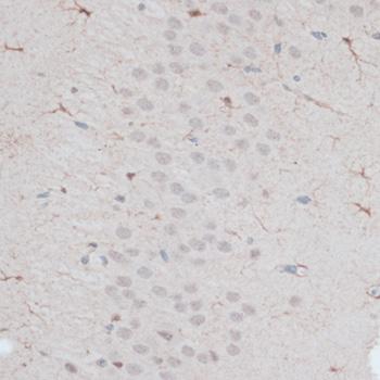 ZNF415 Antibody - Immunohistochemistry of paraffin-embedded Mouse brain using ZNF415 Polyclonal Antibody at dilution of 1:100 (40x lens).
