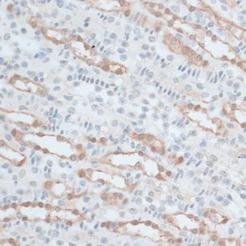 ZNF415 Antibody - Immunohistochemistry of paraffin-embedded Mouse kidney using ZNF415 Polyclonal Antibody at dilution of 1:100 (40x lens).