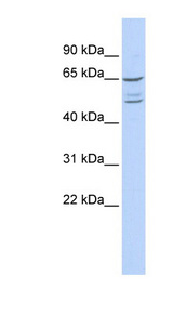 ZNF415 Antibody - ZNF415 antibody Western blot of 293T cell lysate. This image was taken for the unconjugated form of this product. Other forms have not been tested.