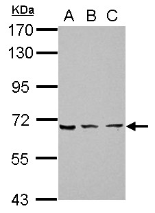 ZNF416 Antibody - Sample (30 ug of whole cell lysate) A: 293T B: A431 C: HeLa 7.5% SDS PAGE ZNF416 antibody diluted at 1:3000