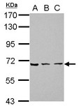 ZNF416 Antibody - Sample (30 ug of whole cell lysate) A: 293T B: A431 C: HeLa 7.5% SDS PAGE ZNF416 antibody diluted at 1:3000