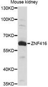 ZNF416 Antibody - Western blot analysis of extracts of mouse kidney, using ZNF416 antibody at 1:1000 dilution. The secondary antibody used was an HRP Goat Anti-Rabbit IgG (H+L) at 1:10000 dilution. Lysates were loaded 25ug per lane and 3% nonfat dry milk in TBST was used for blocking. An ECL Kit was used for detection and the exposure time was 30s.