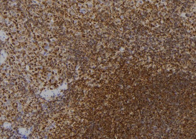 ZNF416 Antibody - 1:100 staining mouse spleen tissue by IHC-P. The sample was formaldehyde fixed and a heat mediated antigen retrieval step in citrate buffer was performed. The sample was then blocked and incubated with the antibody for 1.5 hours at 22°C. An HRP conjugated goat anti-rabbit antibody was used as the secondary.