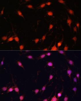ZNF416 Antibody - Immunofluorescence analysis of C6 cells using ZNF416 Polyclonal Antibody at dilution of 1:100.Blue: DAPI for nuclear staining.